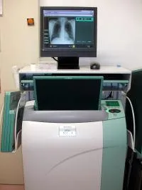 デジタル撮影装置(CR装置)